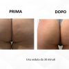 B-LIFT - immagine 4